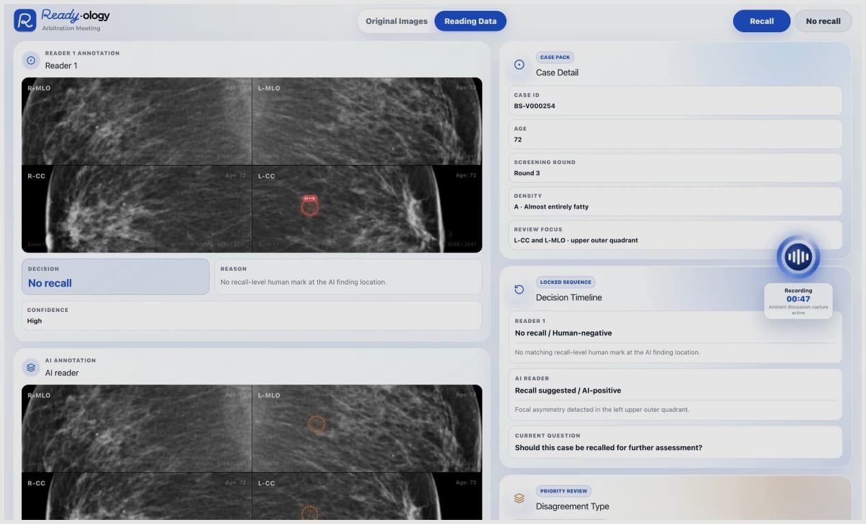 Arbitration View — reader and AI annotations with case detail and decision timeline